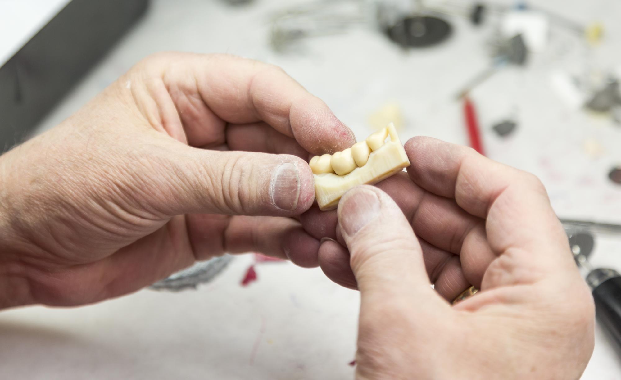 Dental technician holding a ceramic crown restoration